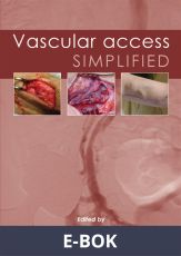 Vascular Access Simplified; second edition, E-bok
